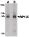 CD180 antigen antibody, LS-C19605, Lifespan Biosciences, Western Blot image 