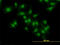 Nuclear Factor Kappa B Subunit 1 antibody, LS-C133346, Lifespan Biosciences, Immunofluorescence image 