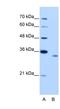 RNA Binding Motif Protein 4B antibody, NBP1-80469, Novus Biologicals, Western Blot image 