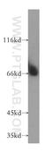 NME/NM23 Family Member 8 antibody, 13586-1-AP, Proteintech Group, Western Blot image 