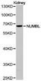 NUMB Like Endocytic Adaptor Protein antibody, LS-C192948, Lifespan Biosciences, Western Blot image 