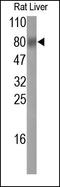 TIMP Metallopeptidase Inhibitor 3 antibody, 250885, Abbiotec, Western Blot image 