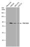 TBC1 Domain Family Member 25 antibody, PA5-78651, Invitrogen Antibodies, Western Blot image 