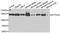 Elongation Factor Tu GTP Binding Domain Containing 2 antibody, A7040, ABclonal Technology, Western Blot image 