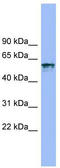 Interleukin 18 Receptor 1 antibody, TA339386, Origene, Western Blot image 