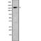 SWI/SNF Related, Matrix Associated, Actin Dependent Regulator Of Chromatin, Subfamily A, Member 2 antibody, abx218669, Abbexa, Western Blot image 