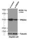 Peroxiredoxin 4 antibody, 60286-1-Ig, Proteintech Group, Western Blot image 