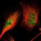 S100 Calcium Binding Protein A9 antibody, NBP1-89360, Novus Biologicals, Immunocytochemistry image 