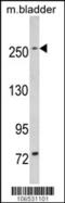 Leucine Rich Repeat Kinase 1 antibody, 62-659, ProSci, Western Blot image 