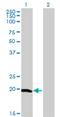 Centrin 1 antibody, H00001068-M05, Novus Biologicals, Western Blot image 