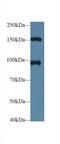 Nucleoporin 98 antibody, MBS2013788, MyBioSource, Western Blot image 