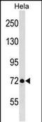 LAS1 Like, Ribosome Biogenesis Factor antibody, PA5-48847, Invitrogen Antibodies, Western Blot image 