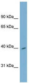 Core histone macro-H2A.2 antibody, TA344844, Origene, Western Blot image 