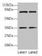 Heterogeneous Nuclear Ribonucleoprotein H1 antibody, LS-C211727, Lifespan Biosciences, Western Blot image 