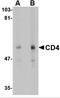 CD4 antibody, TA349004, Origene, Western Blot image 