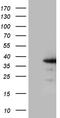 Zinc Finger CCHC-Type Containing 17 antibody, LS-C792126, Lifespan Biosciences, Western Blot image 