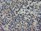 RASD Family Member 2 antibody, NBP2-03331, Novus Biologicals, Immunohistochemistry paraffin image 