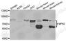 Mitofusin 2 antibody, A5750, ABclonal Technology, Western Blot image 