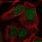 Cytidine deaminase antibody, NBP2-39019, Novus Biologicals, Immunocytochemistry image 