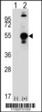 Chondromodulin antibody, 61-461, ProSci, Western Blot image 