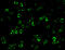 Inhibitor Of Nuclear Factor Kappa B Kinase Subunit Beta antibody, 2121, ProSci Inc, Immunofluorescence image 
