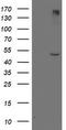 Lipoprotein Lipase antibody, LS-C337533, Lifespan Biosciences, Western Blot image 