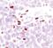 Arachidonate 5-Lipoxygenase antibody, MA5-14838, Invitrogen Antibodies, Immunohistochemistry paraffin image 