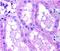 NADPH Oxidase 4 antibody, NB110-58849B, Novus Biologicals, Immunohistochemistry paraffin image 