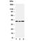 C-C Motif Chemokine Receptor 5 (Gene/Pseudogene) antibody, R30188, NSJ Bioreagents, Western Blot image 