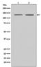 Apoptotic Peptidase Activating Factor 1 antibody, M00889, Boster Biological Technology, Western Blot image 