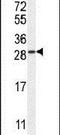 TIFA Inhibitor antibody, PA5-24376, Invitrogen Antibodies, Western Blot image 