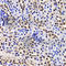 GA Binding Protein Transcription Factor Subunit Beta 1 antibody, A6909, ABclonal Technology, Immunohistochemistry paraffin image 