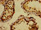 WW Domain Containing Oxidoreductase antibody, CSB-PA873704LA01HU, Cusabio, Immunohistochemistry paraffin image 
