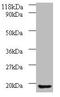 Adaptor Related Protein Complex 1 Subunit Sigma 3 antibody, LS-B12275, Lifespan Biosciences, Western Blot image 