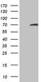 Hyaluronan Binding Protein 2 antibody, CF809338, Origene, Western Blot image 