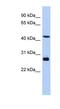 Synaptotagmin 9 antibody, NBP1-60112, Novus Biologicals, Western Blot image 