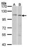 Checkpoint Kinase 1 antibody, orb14523, Biorbyt, Western Blot image 