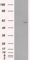 Cytochrome P450 Family 1 Subfamily A Member 2 antibody, GTX84638, GeneTex, Western Blot image 