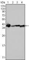 Nucleophosmin 1 antibody, STJ97858, St John