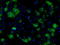 Fumarylacetoacetate Hydrolase Domain Containing 2A antibody, LS-C114996, Lifespan Biosciences, Immunofluorescence image 