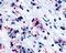 CYSLTR1 antibody, PA1-32500, Invitrogen Antibodies, Immunohistochemistry frozen image 