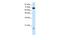 Tripartite Motif Containing 32 antibody, A03750, Boster Biological Technology, Western Blot image 