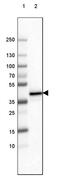 Fc Fragment Of IgG Receptor And Transporter antibody, MA5-24660, Invitrogen Antibodies, Western Blot image 