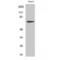 Matrix metalloproteinase-16 antibody, LS-C384690, Lifespan Biosciences, Western Blot image 