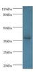 ATPase H+ Transporting Accessory Protein 2 antibody, LS-C369294, Lifespan Biosciences, Western Blot image 