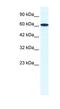 Zinc Finger Protein 266 antibody, NBP1-80114, Novus Biologicals, Western Blot image 