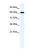 Zinc Finger Protein 266 antibody, NBP1-80114, Novus Biologicals, Western Blot image 