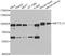 EEF1A Lysine And N-Terminal Methyltransferase antibody, A7111, ABclonal Technology, Western Blot image 