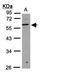 UDP-GlcNAc:BetaGal Beta-1,3-N-Acetylglucosaminyltransferase 3 antibody, GTX108928, GeneTex, Western Blot image 
