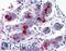 Mucin 1, Cell Surface Associated antibody, LS-B4242, Lifespan Biosciences, Immunohistochemistry frozen image 